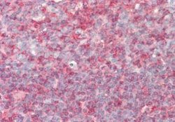 PIP5K1 alpha Antibody, Novus Biologicals PI4K a, type I Antibody; Unconjugated;
