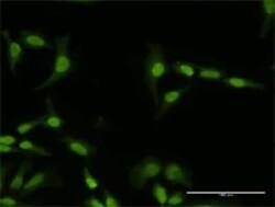 PI4K2A Antibody, Novus Biologicals 0.1 mg | Buy Online | Novus Biologicals | Fisher Scientific