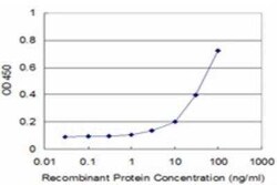 PI4KB/PI4KIII beta Antibody (3B1), Novus Biologicals 0.1 mg, Unconjugated:Antibodies,