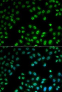 PIAS1 Antibody - BSA Free, Novus Biologicals 0.02 mL; Unconjugated:Antibodies,