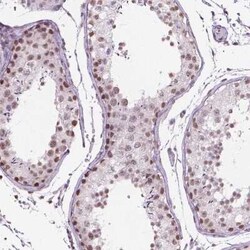 PIAS2 Antibody, Novus Biologicals:Antibodies:Primary Antibodies