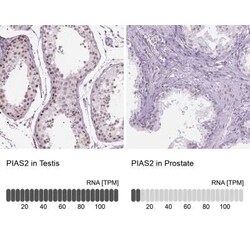 PIAS2 Antibody, Novus Biologicals:Antibodies:Primary Antibodies