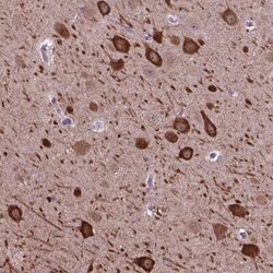 PIAS3 Antibody, Novus Biologicals 25 &mu;L, Unconjugated:Antibodies, Polyclonal