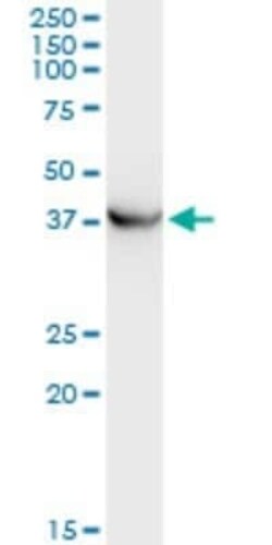 PICK1 Antibody (3G5), Novus Biologicals 0.1 mg | Buy Online | Novus Biologicals | Fisher Scientific