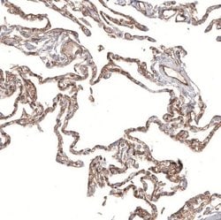 PIEZO1 Antibody (CL9714), Novus Biologicals 100 &mu;L; Unconjugated:Antibodies,