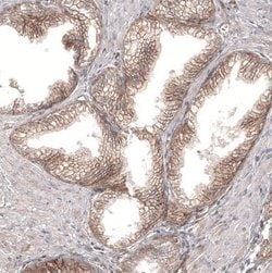 PIEZO1 Antibody (CL9714), Novus Biologicals 100 &mu;L; Unconjugated:Antibodies,
