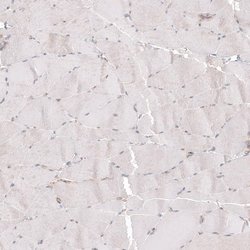PIEZO1 Antibody (CL9714), Novus Biologicals 100 &mu;L; Unconjugated:Antibodies,