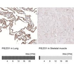 PIEZO1 Antibody (CL9714), Novus Biologicals 100 &mu;L; Unconjugated:Antibodies,