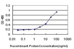 PIGL Antibody (2B6), Novus Biologicals 0.1 mg | Buy Online | Novus Biologicals | Fisher Scientific