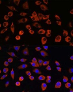PIGM Antibody - Azide and BSA Free, Novus Biologicals:Antibodies:Primary