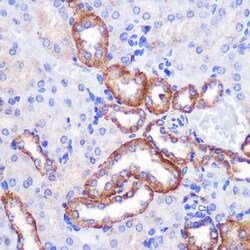 PIGM Antibody - Azide and BSA Free, Novus Biologicals:Antibodies:Primary
