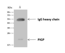PIGP Antibody, Novus Biologicals:Anticorps:Anticorps primaires
