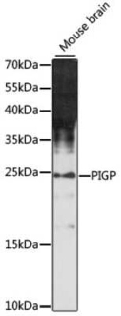 PIGP Antibody - Azide and BSA Free, Novus Biologicals:Antibodies:Primary