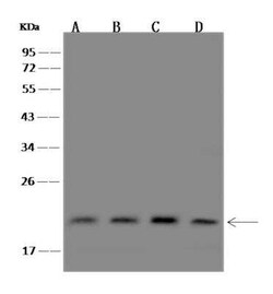 PIGP Antibody, Novus Biologicals:Anticorps:Anticorps primaires