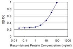 PIGT Antibody (2A2), Novus Biologicals 0.1 mg, Unconjugated:Antibodies,
