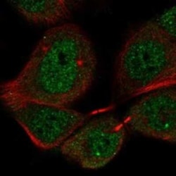 PIGX Rabbit anti-Human, Polyclonal, Novus Biologicals 25 &mu;g; Unconjugated:Antibodies,
