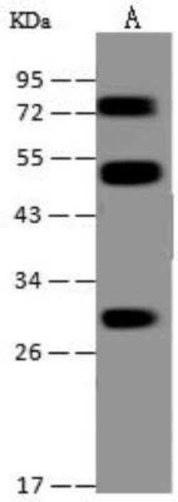 PIGX Antibody, Novus Biologicals 100 &mu;g | Buy Online | Novus Biologicals | Fisher Scientific