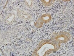 PIH1D1 Antibody (1E8), Novus Biologicals 0.1 mg | Buy Online | Novus Biologicals | Fisher Scientific