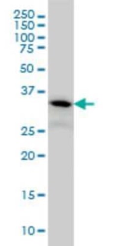 PIH1D1 Antibody (1E8), Novus Biologicals 0.1 mg | Buy Online | Novus Biologicals | Fisher Scientific
