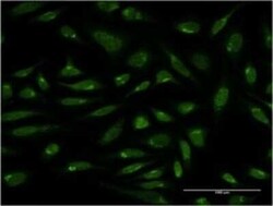 PIH1D1 Antibody (4F5-1E10), Novus Biologicals 0.1 mg | Buy Online | Novus Biologicals | Fisher Scientific