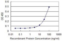 PIH1D1 Antibody (4H7), Novus Biologicals 0.1 mg | Buy Online | Novus Biologicals | Fisher Scientific