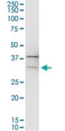 PIH1D1 Antibody, Novus Biologicals 0.05 mg | Buy Online | Novus Biologicals | Fisher Scientific