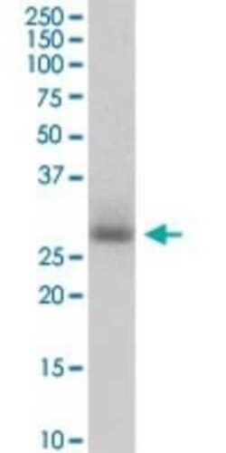 PIH1D1 Antibody, Novus Biologicals 0.05 mg | Buy Online | Novus Biologicals | Fisher Scientific