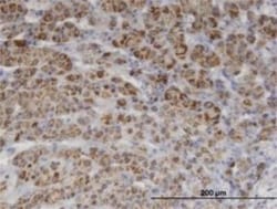 PIK3C2A Antibody (3E7), Novus Biologicals 0.1 mg | Buy Online | Novus Biologicals | Fisher Scientific