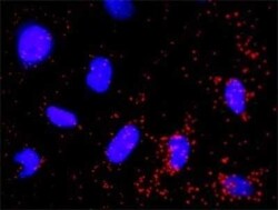 PI 3-Kinase p55 gamma Antibody (2F8), Novus Biologicals 0.1 mg | Buy Online | Novus Biologicals | Fisher Scientific