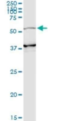 PI 3-Kinase p55 gamma Antibody (2F8), Novus Biologicals 0.1 mg | Buy Online | Novus Biologicals | Fisher Scientific