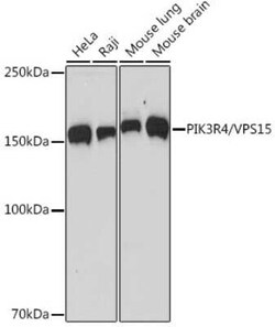 PIK3R4 Rabbit anti-Human, Mouse, Rat, Clone: 5J3U5, Novus Biologicals 20 &mu;g | Buy Online | Novus Biologicals | Fisher Scientific