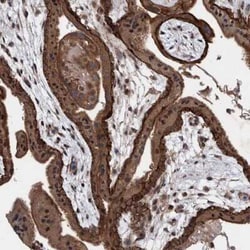 PIK3R6 Antibody, Novus Biologicals:Antibodies:Primary Antibodies
