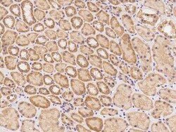 PIKFyve/PIP5K3 Antibody, Novus Biologicals 100 &mu;g | Buy Online | Novus Biologicals | Fisher Scientific