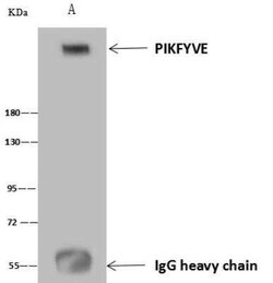 PIKFyve/PIP5K3 Antibody, Novus Biologicals 100 &mu;g | Buy Online | Novus Biologicals | Fisher Scientific