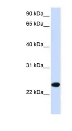 PILR-beta Antibody, Novus Biologicals 100 &mu;g; Unconjugated:Antibodies,
