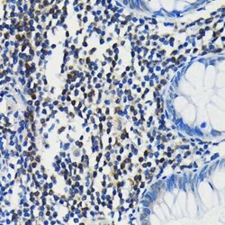 PIM1 Rabbit anti-Human, Mouse, Rat, Clone: 4C8D0, Novus Biologicals 20