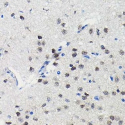 PIM1 Rabbit anti-Human, Mouse, Rat, Clone: 4C8D0, Novus Biologicals 20