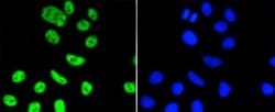 PIM1 Antibody (ST0513), Novus Biologicals 100&mu;L:Antibodies, Monoclonal