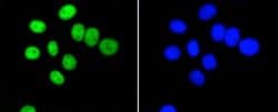 PIM1 Antibody (ST0513), Novus Biologicals 100&mu;L:Antibodies, Monoclonal
