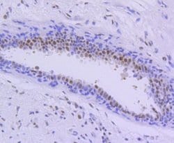 PIM1 Antibody (ST0513), Novus Biologicals 100&mu;L:Antibodies, Monoclonal