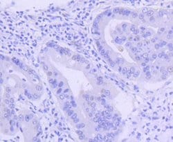 PIM1 Antibody (ST0513), Novus Biologicals 100&mu;L:Antibodies, Monoclonal