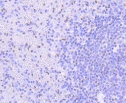 PIM1 Antibody (ST0513), Novus Biologicals 100&mu;L:Antibodies, Monoclonal