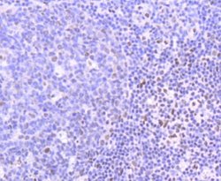 PIM1 Antibody (ST0513), Novus Biologicals 100&mu;L:Antibodies, Monoclonal