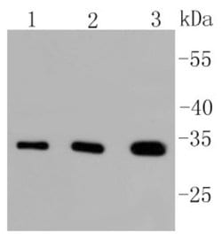 PIM1 Antibody (ST0513), Novus Biologicals 100&mu;L:Antibodies, Monoclonal