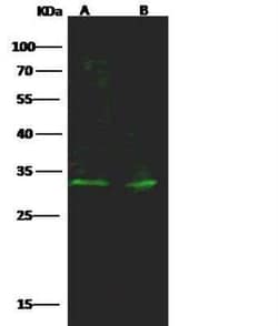 PIM1 Antibody, Novus Biologicals 50 &mu;g | Buy Online | Novus Biologicals | Fisher Scientific