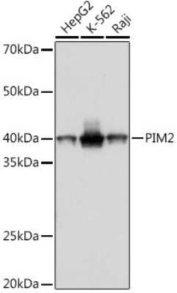 PIM2 Rabbit anti-Human, Clone: 3V1S5, Novus Biologicals 100 &mu;g; Unconjugated:Antibodies,