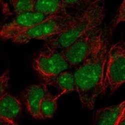 PINX1 Rabbit anti-Human, Polyclonal, Novus Biologicals:Antibodies:Primary