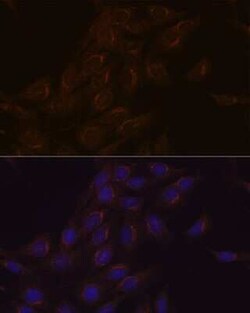 PIST Rabbit anti-Human, Mouse, Rat, Clone: 2B1P9, Novus Biologicals:Antibodies:Primary