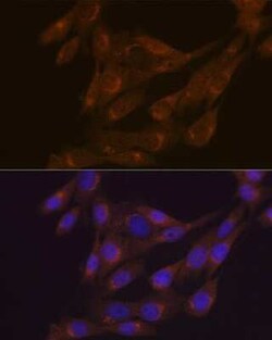 PIST Rabbit anti-Human, Mouse, Rat, Clone: 2B1P9, Novus Biologicals:Antibodies:Primary