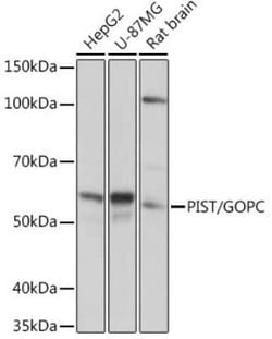 PIST Rabbit anti-Human, Mouse, Rat, Clone: 2B1P9, Novus Biologicals:Antibodies:Primary